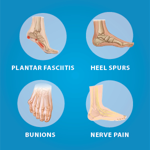 Plantar fasciitis sale chemist warehouse